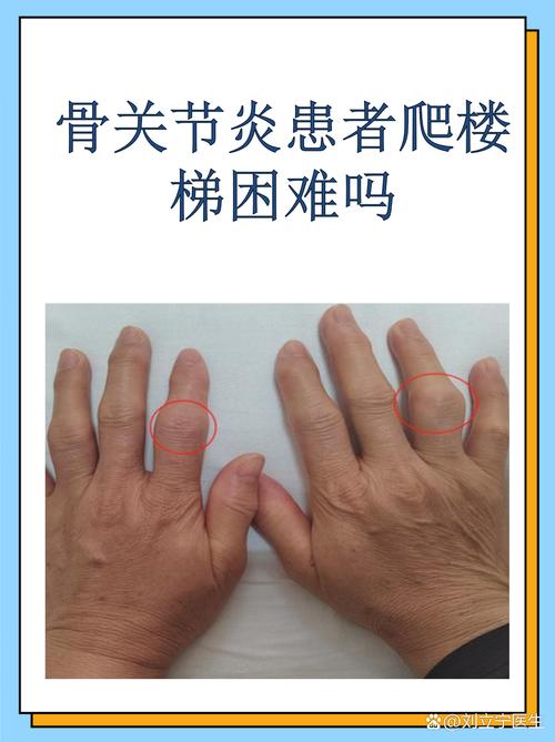 朗尼克:莱默感到膝盖不舒服,我们不希望他冒风险 朗尼克:莱默感到膝盖不舒服,我们不希望他冒风险